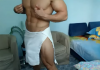 Massage kích dục sung sướng, cụ ông 70 tuổi bị rận mu tấn công